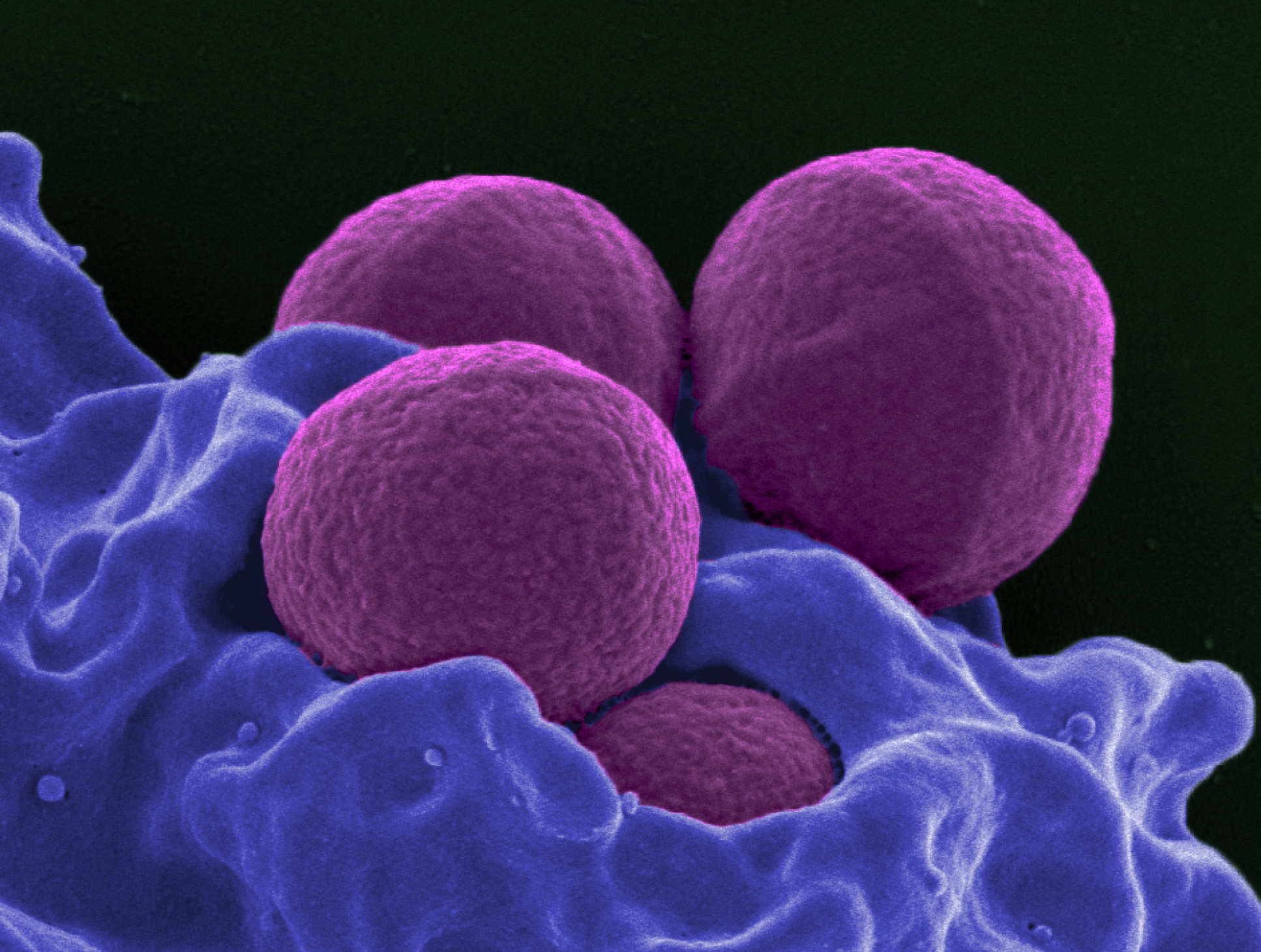 MRSA is just one of a growing number of bugs resistant to antibiotics