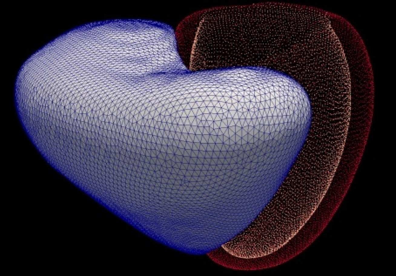 Computer software creates a 3D virtual heart from MRI scans, then learns to predict when patients will die