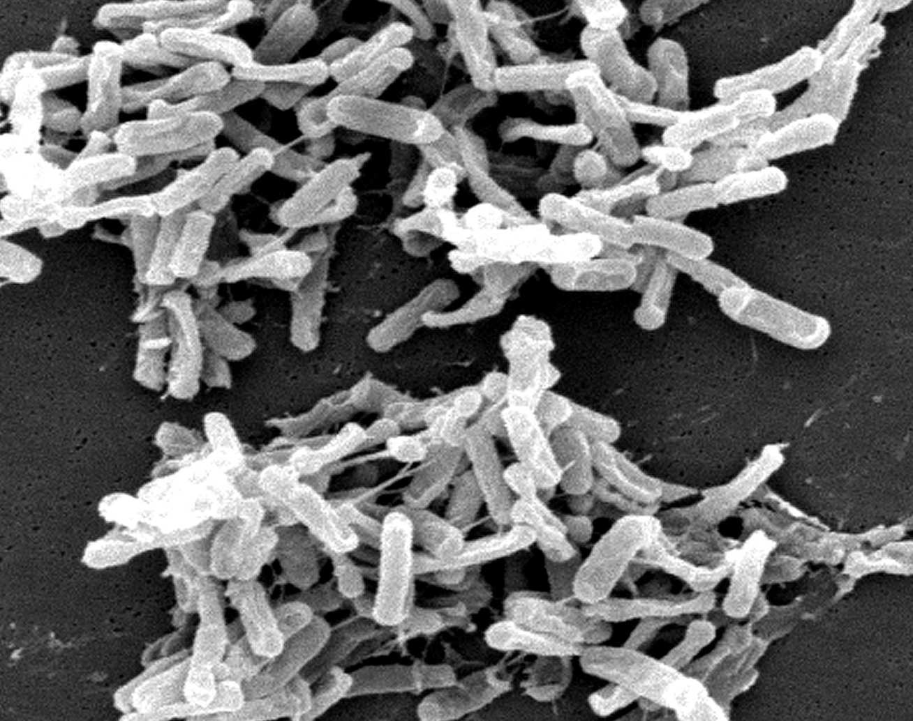 An electron micrograph of C. diff