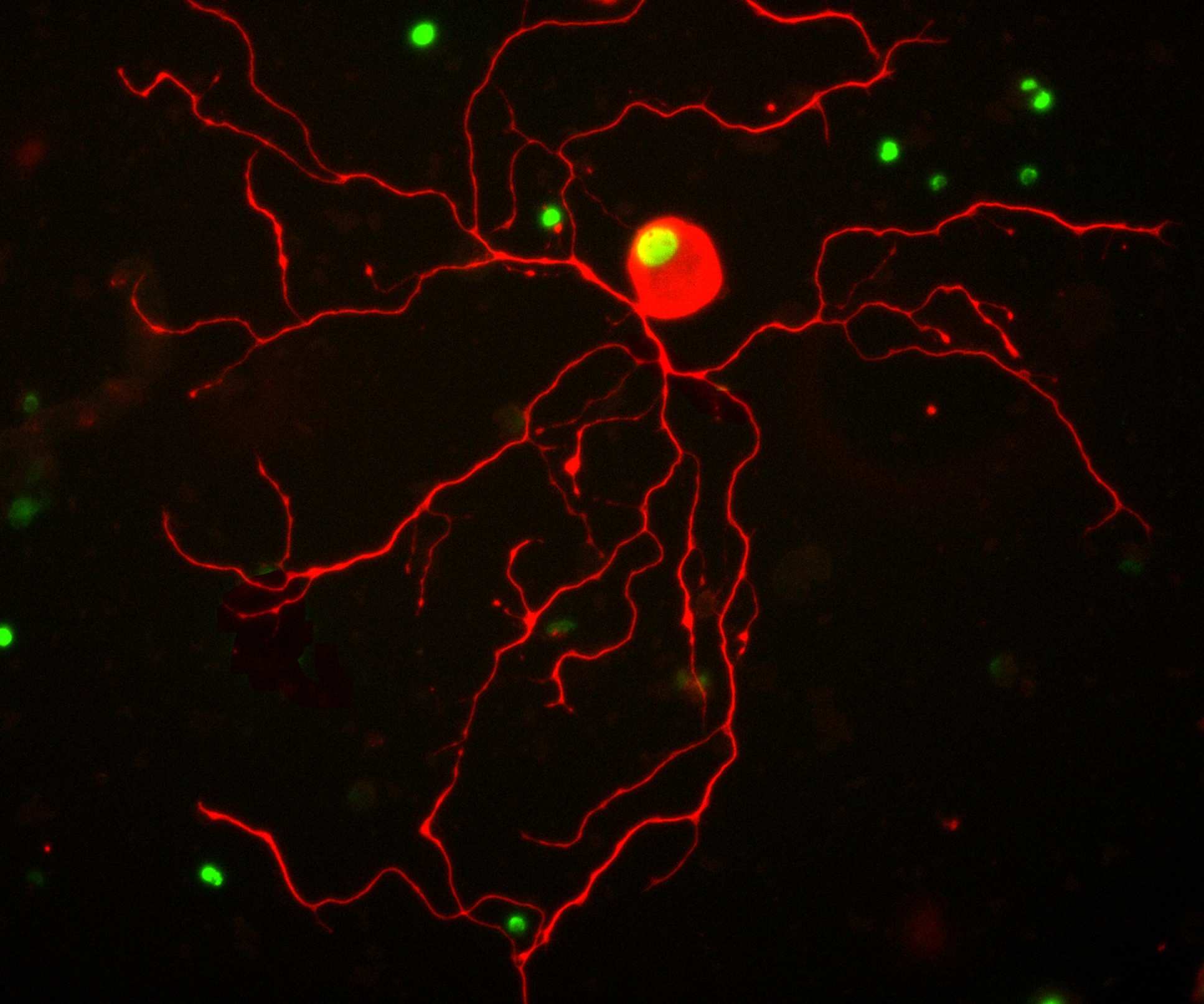 Image of a nerve cell branching out, stained with fluorescent markers