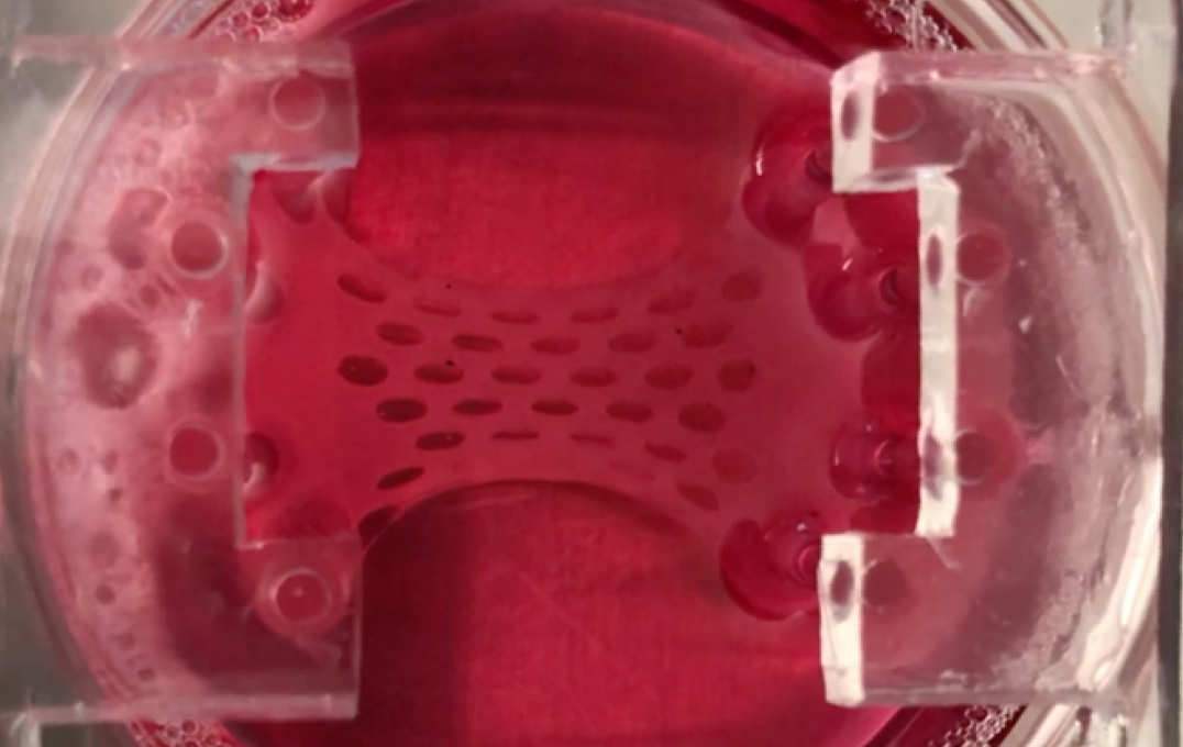 The heart repair patch, created from human cells