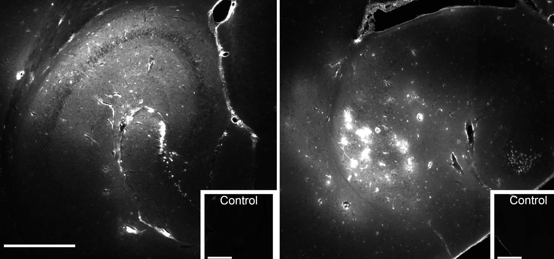 Two images side by side showing difference in evenness of drug delivery depending on pulse lengths. Left side: The short-wave pulses delivered the drug evenly throughout the brain. Right side: The long-wave pulses delivered the drug unevenly. Both images show the drug only affects the targeted areas.