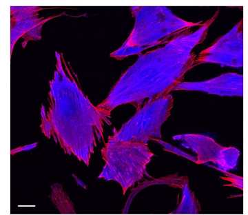 Geranylgeranylated RhoB in HPAECs