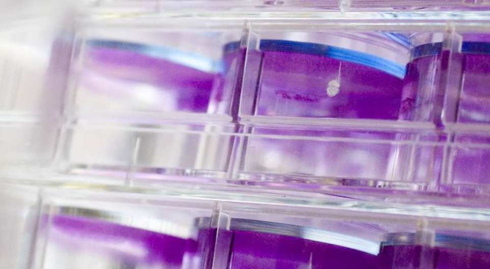 Planning for a pandemic