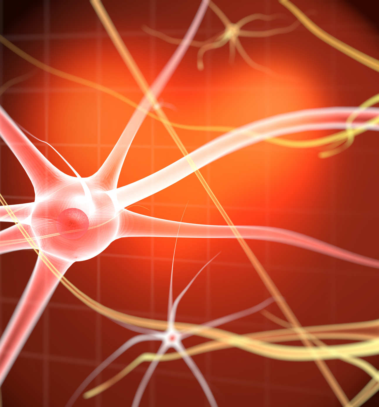An illustration showing an inflamed nerve
