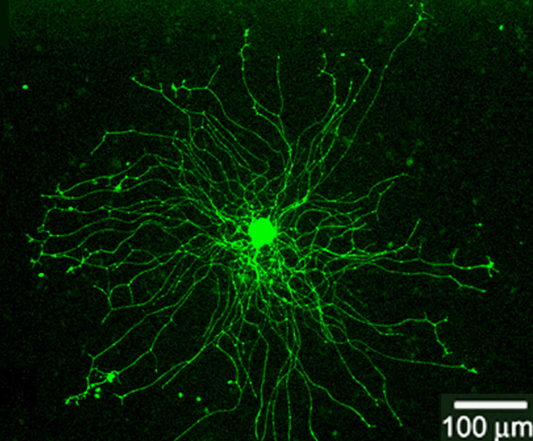 Gap43 positive Rat DRG neuron