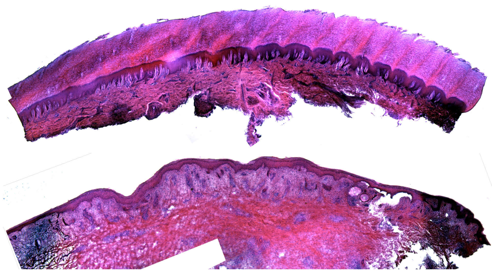 Top and bottom comparison images showing that layers of foot sole (plantar) skin are much thicker than body skin.