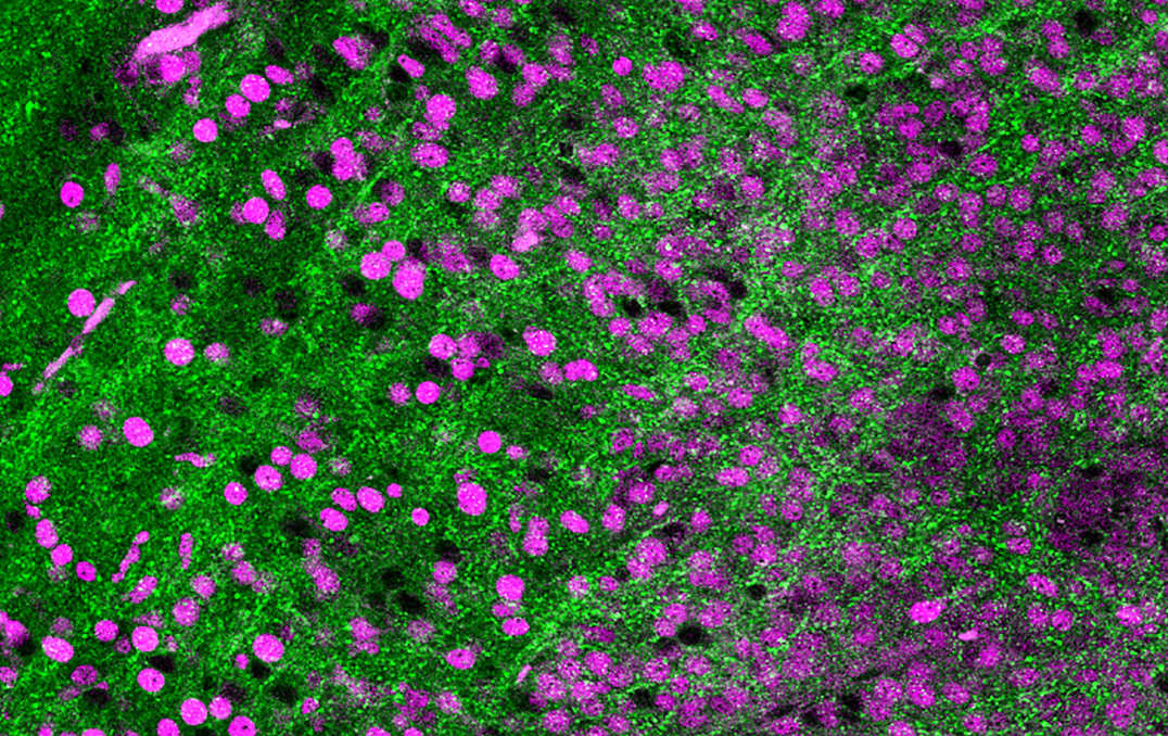 Synaptic connections (green) in human brain cell transplant (purple)