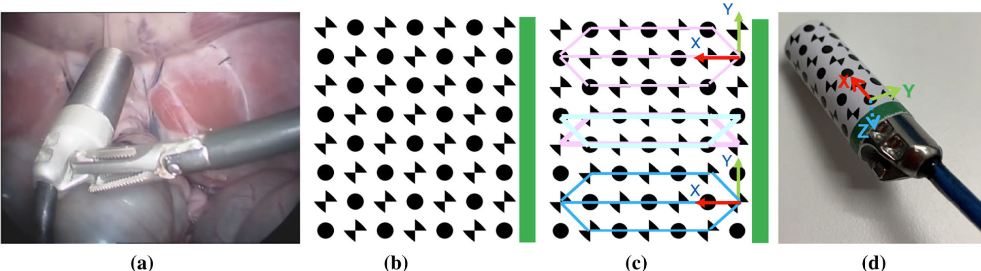 a An example of a tethered probe being used in MIS; b the gamma probe marker; c example detected circular dots and chessboard vertices; d the local coordinates defined on the probe