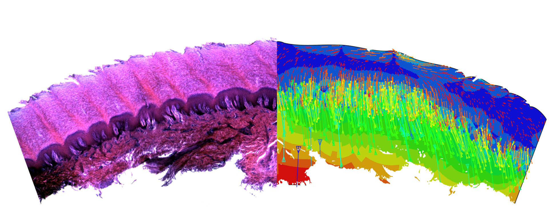 Side by side comparison images showing difference in load bearing between foot sole (plantar) and body skin