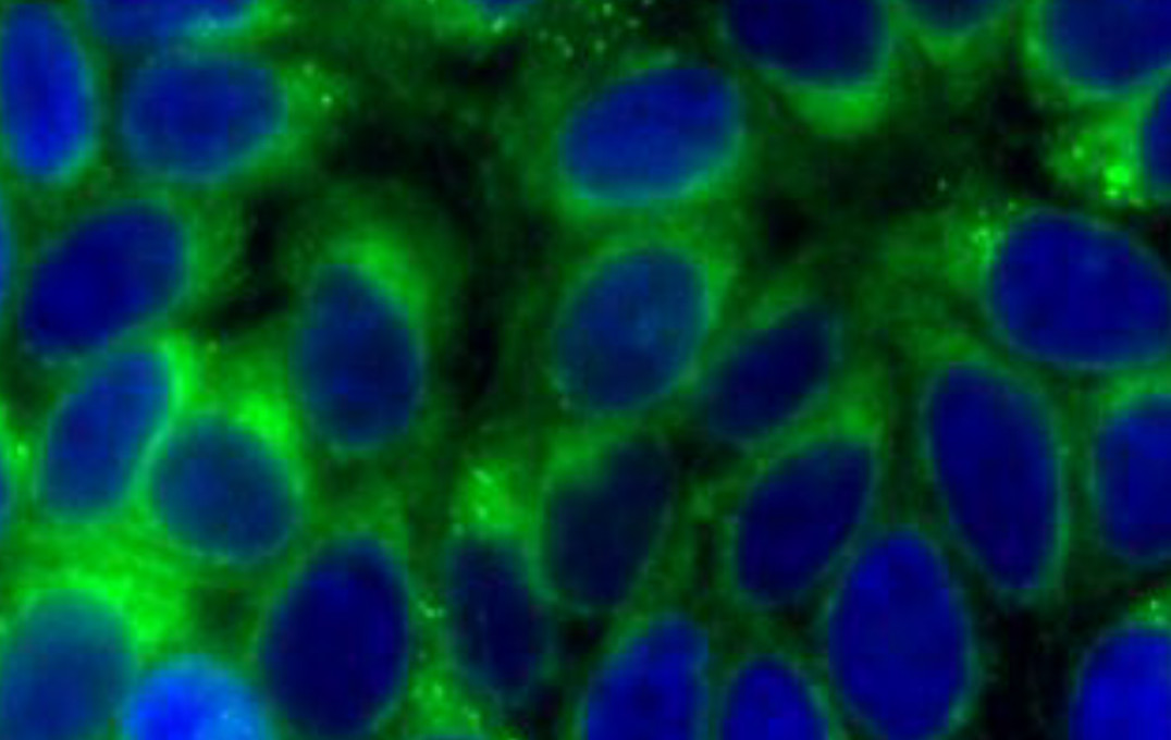 Blue cells surrounded by a green fringe