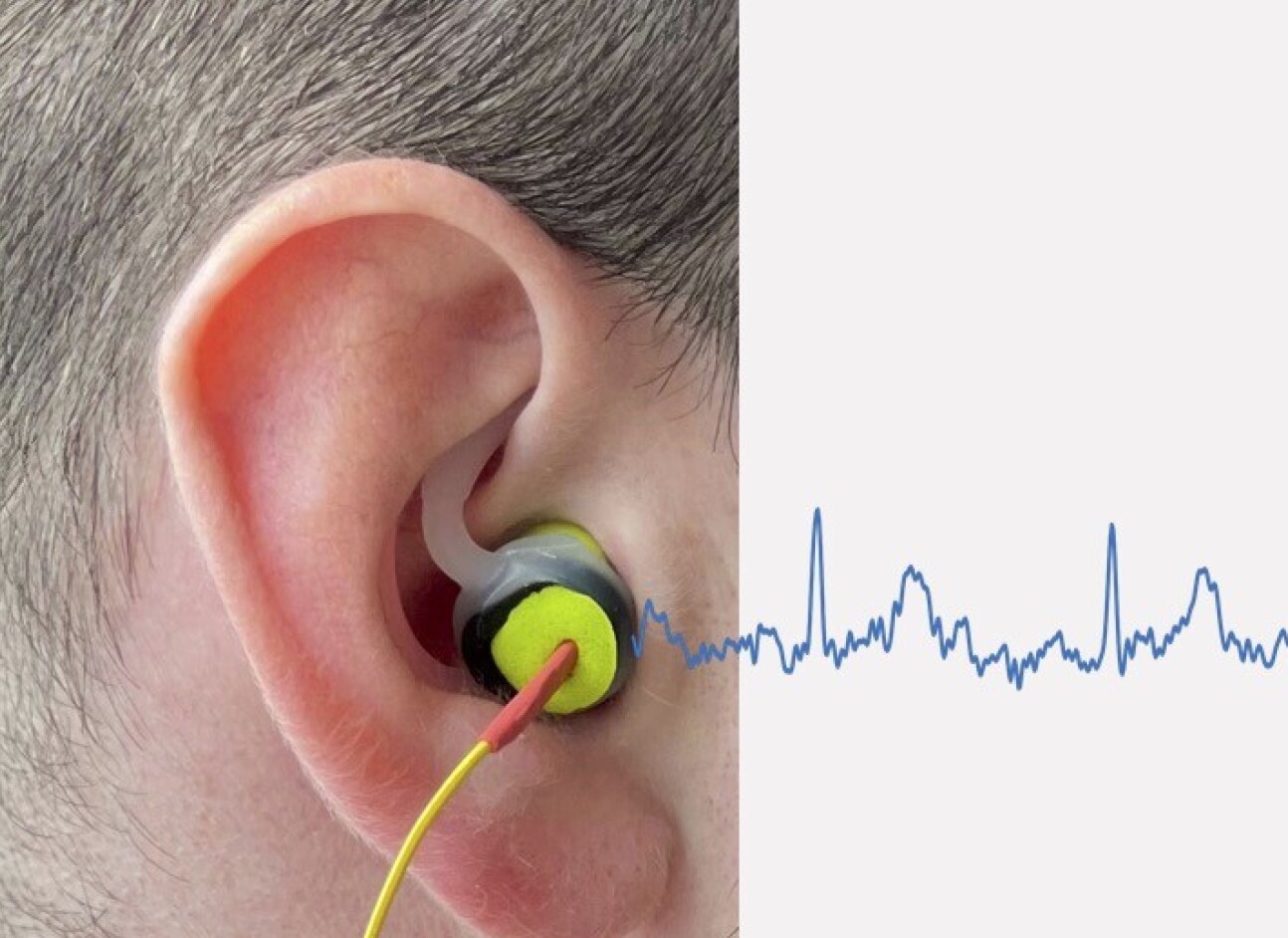 An ear with ECG signals extending from it