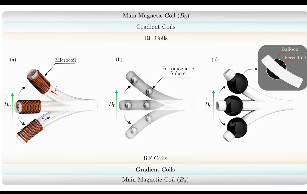 Distal end of MR-actuated Magnetic Catheters (a) (Simplified, Single Plane) microcoil-based: a microcoil is attached to a flexible tubing. Depending on the direction of flow of current, the distal bend is steered in a specific direction accordingly. (b) Ferromagnetic sphere-based: The deflectable tip consists of ferromagnetic spheres. (c) Ferrofluid-based: The distal end comprises a balloon filled with a ferrofluid. All three distal ends (a)–(c) experience a turning force or torque to align its local magnetic field with the external field of the MRI scanner. The distal ends in the figure are placed within the bore of the MRI scanner, indicated by the three main components: main magnetic coil, gradient coils and RF Coils.