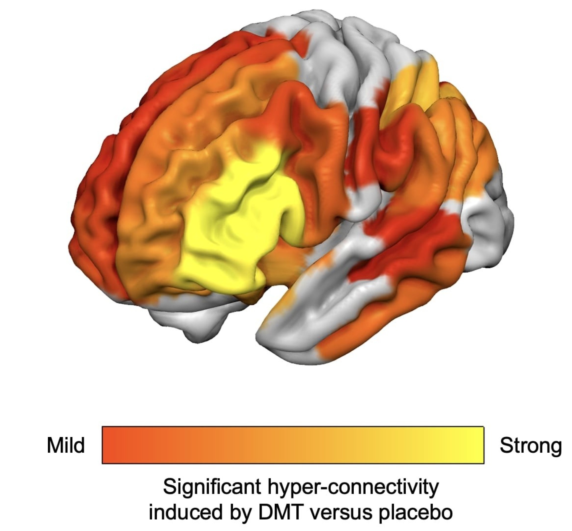 CGI model showing areas of hyper-connectivity in the brain under DMT.