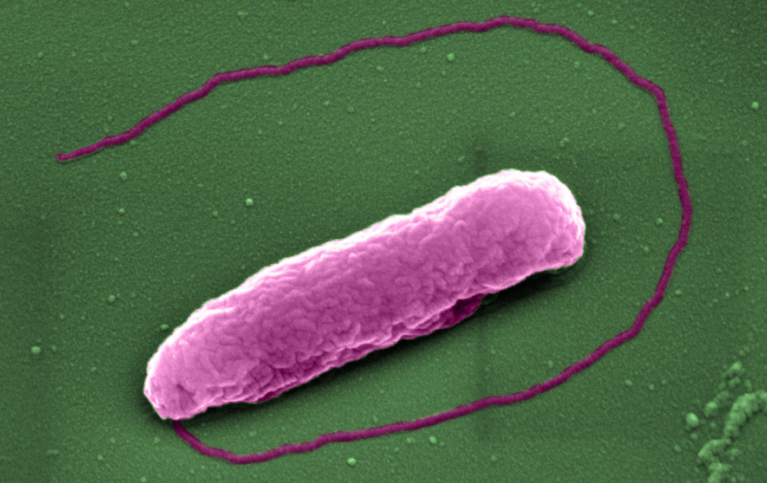 The superbug Pseudomonas aeruginosa, which can cause lung infections in people on ventilators in Intensive Care Units.
