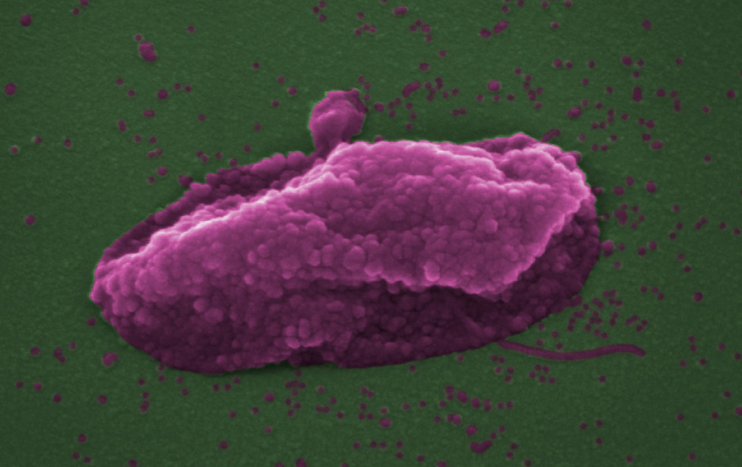 The superbug Pseudomonas aeruginosa after being ‘popped’ by the antibiotic colistin.  
