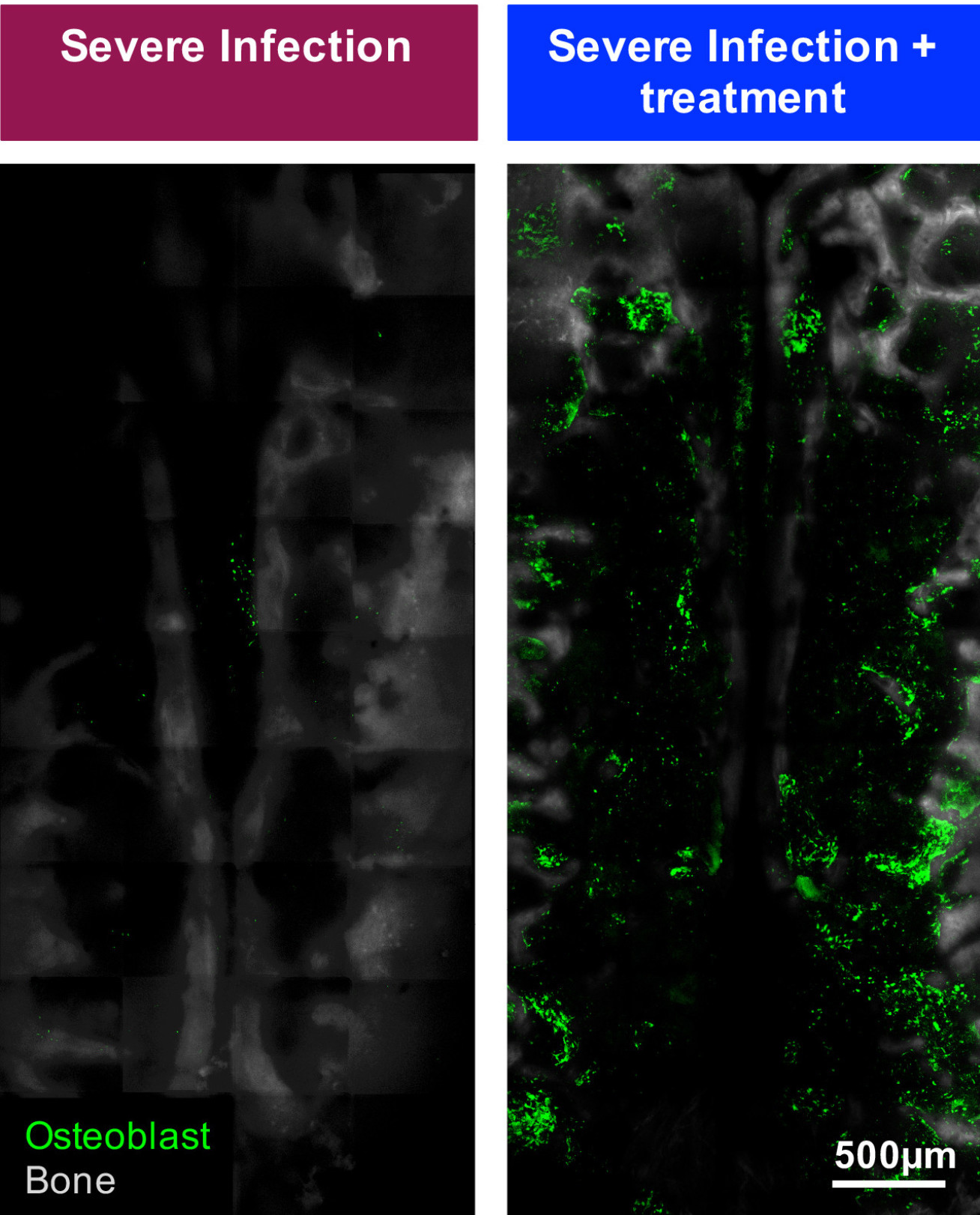 Comparison of osteoblast density (green) before and after treatment, showing great improvement