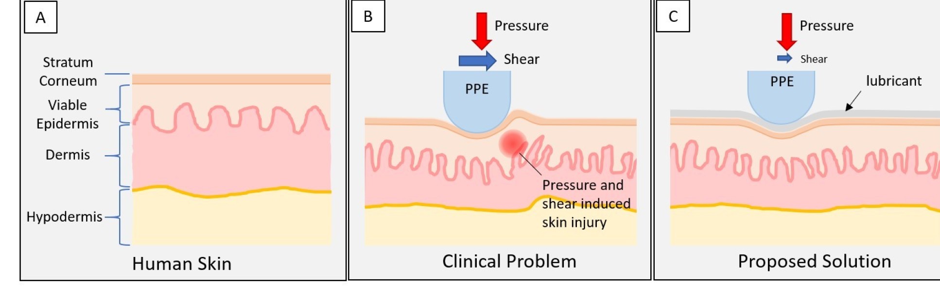 Diagram of skin in three states: one without PPE, the second with added pressure from forces by the PPE (friction, shear) and subsequent damage, and third with a layer of protective lubrication, causing no damage