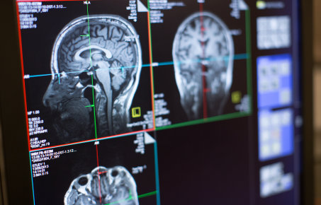 brain scans