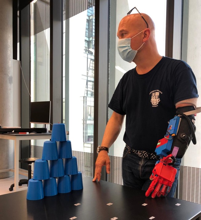 Photo of the pilot practicing cup stacking with his prosthetic arm