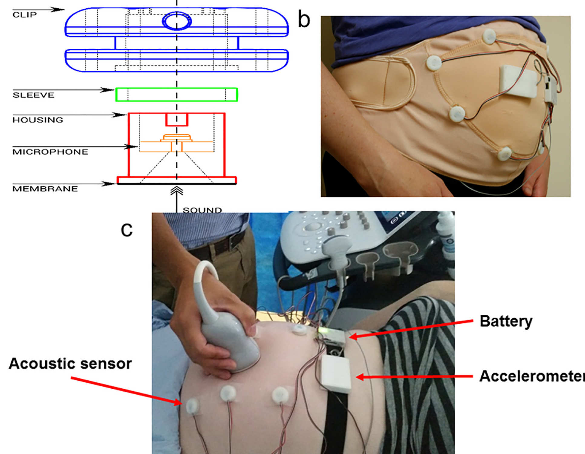 Images and a diagram of the new technology