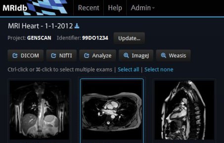 MRIdb