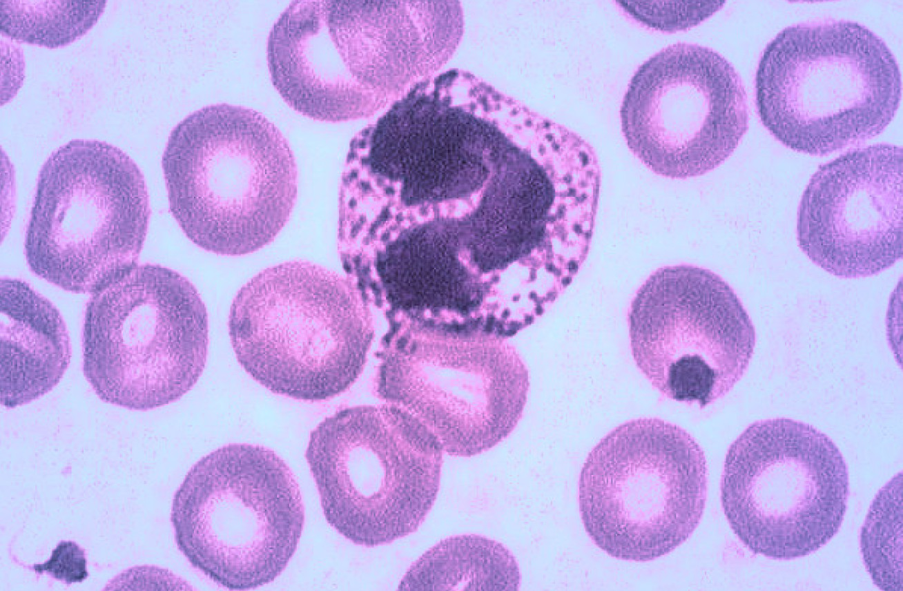 Neutrophil on a blood smear