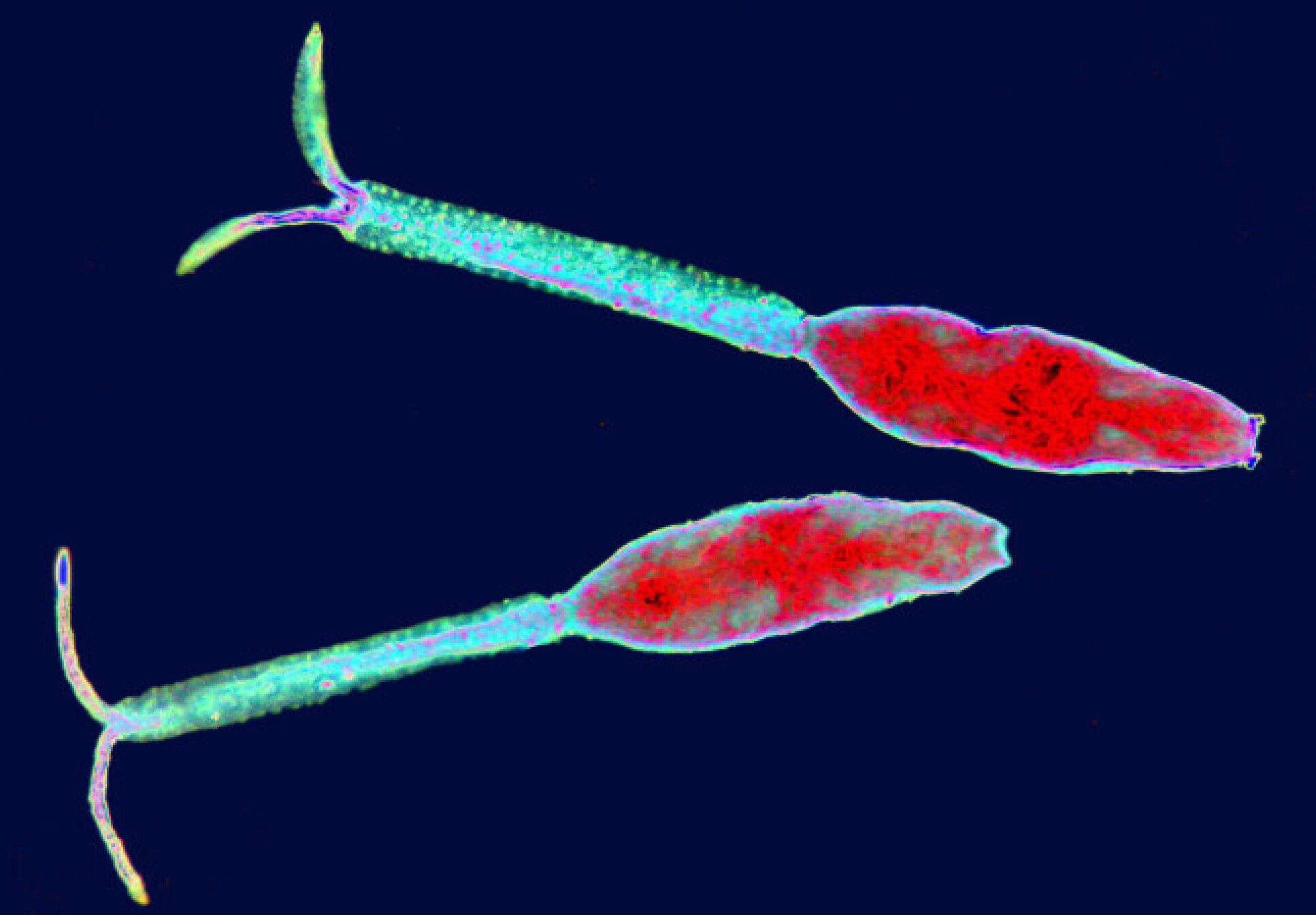 Larval forms of the parasitic worms that cause schistosomiasis