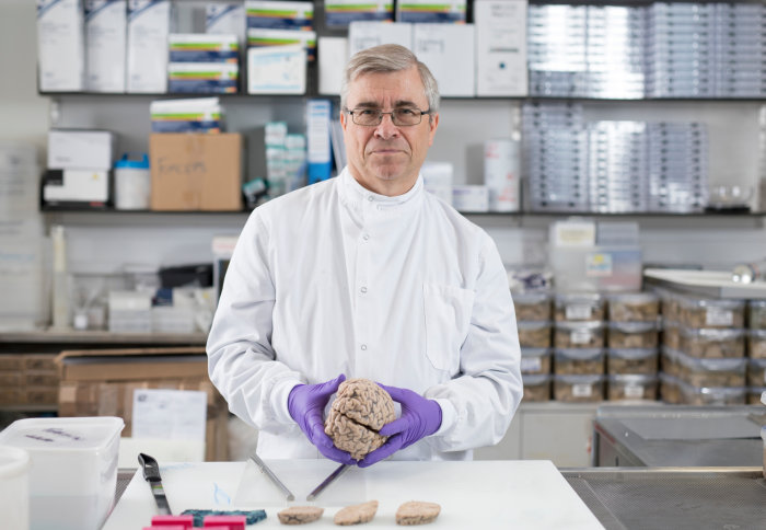 Professor Richard Reynolds holds a human brain in his hands