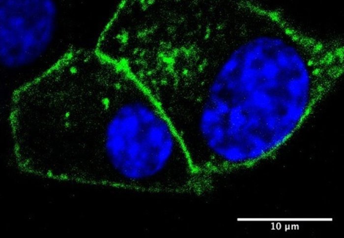 Cell nucleus (blue) with drug receptors (green)