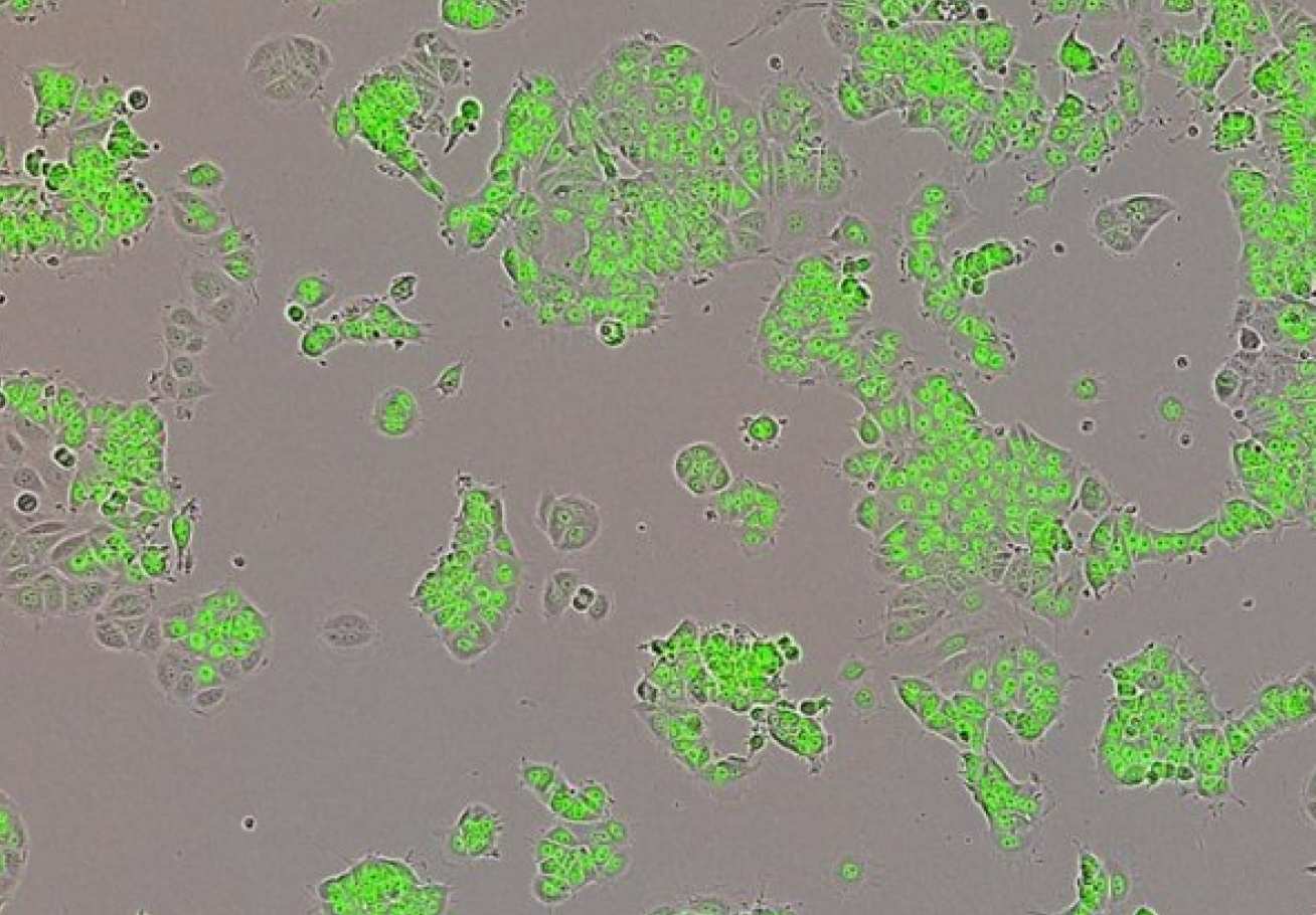 Human breast cancer cells (green)
