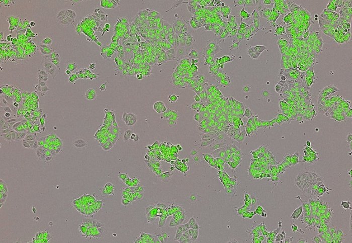 Human breast cancer cells (green)