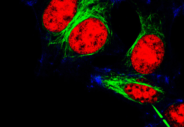 Ovarian cancer cells