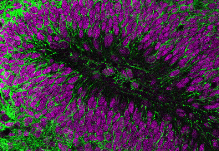 Transplanted human brain cells (green) and nuclei (purple)