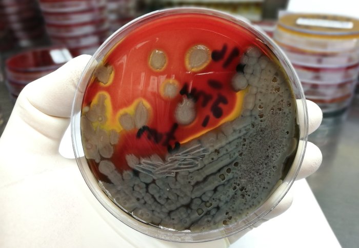 Gloved hand holding a petri dish covered in grey bacteria