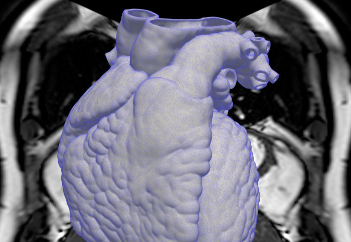 A 3D scan of a human heart
