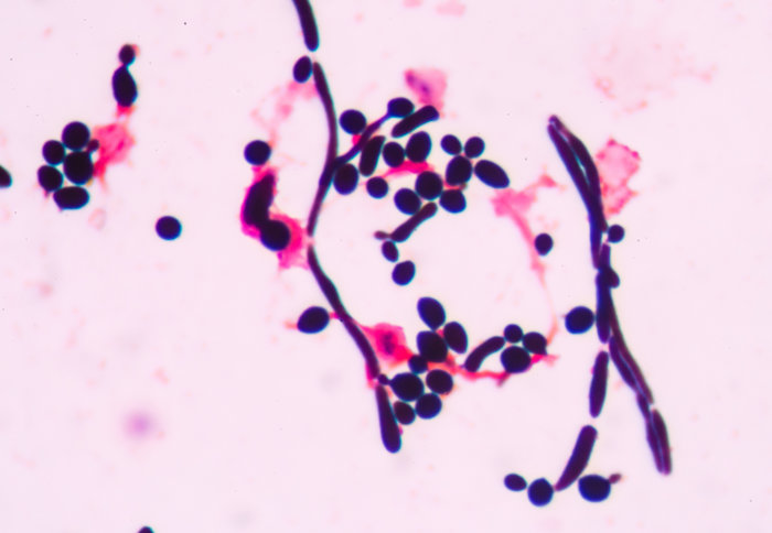 Close up image of budding yeast cells
