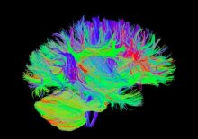 Diffusion tensor imaging illustrates white matter connections in the brain