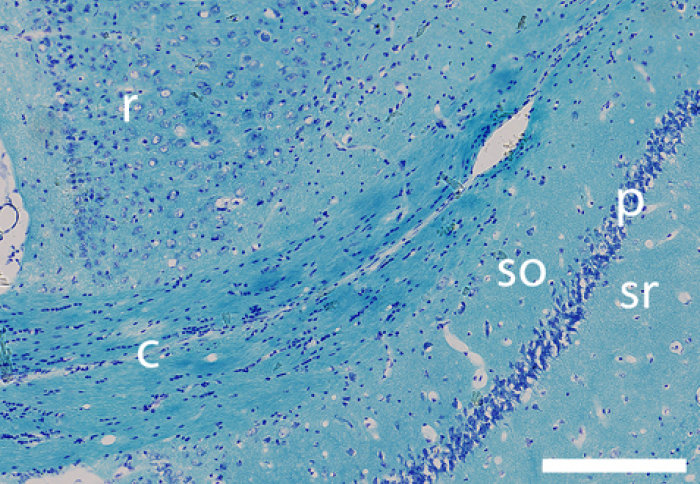 Histological image showing that Xenon treatment prevented long-term degeneration of nerve fibres in the corpus callosum