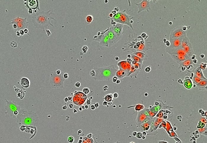 Dormant 'sleeper' cells (red) and active cancer cells (green)