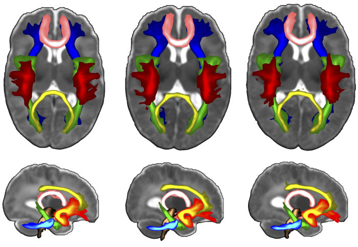 Brain scans of babies showing developmental pathways