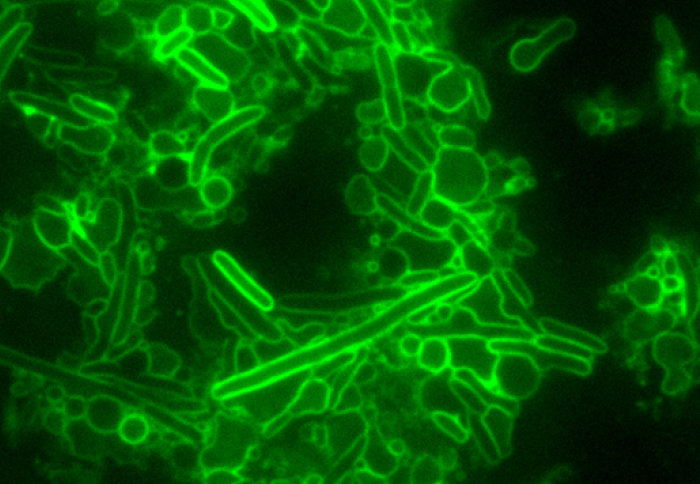 Blobs and tubes of bacteria outlined in green