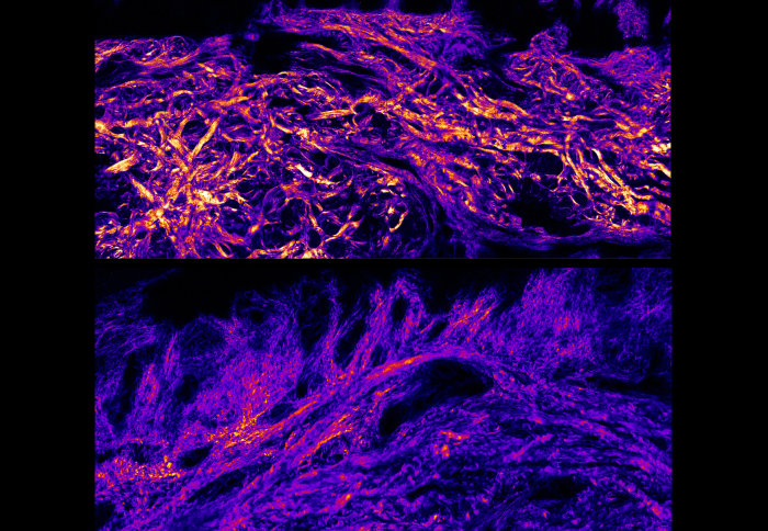 Top and bottom comparison images showing that collagen bundles and collagen fibres in foot sole (plantar) skin are much thicker than body skin.