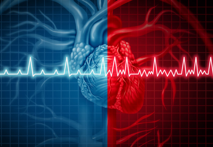 Illustration of a heart with overlaid unequal heart traces