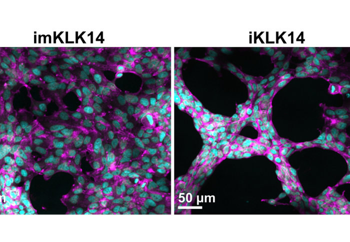 KLK14 mutant cells