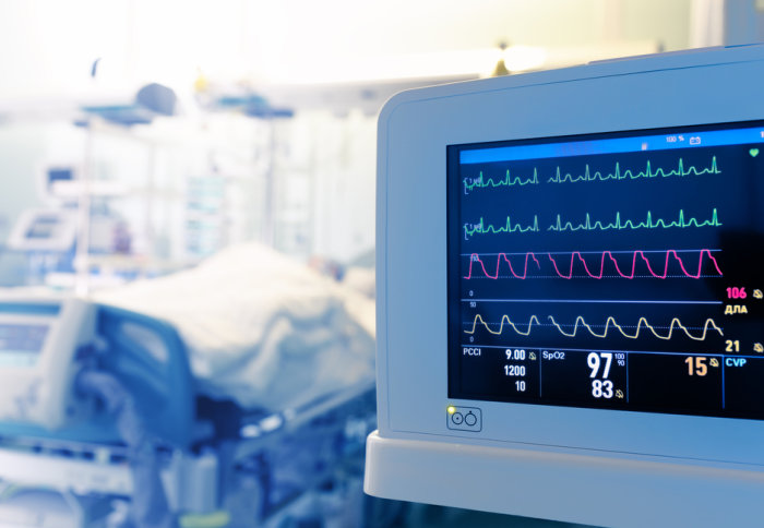 Image of a heart monitor with hospital bed in background