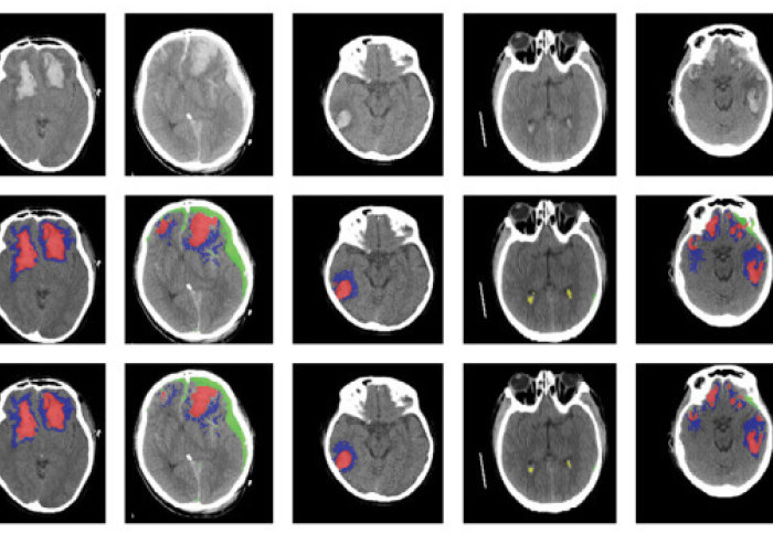 Image of brain scans processed by the machine learning algorithm