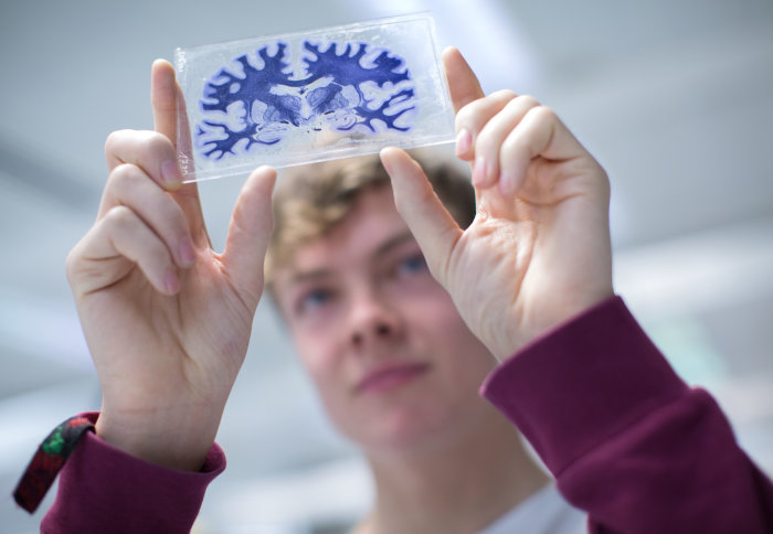 An undergraduate neuroscience student holding a microscope slide of a brain