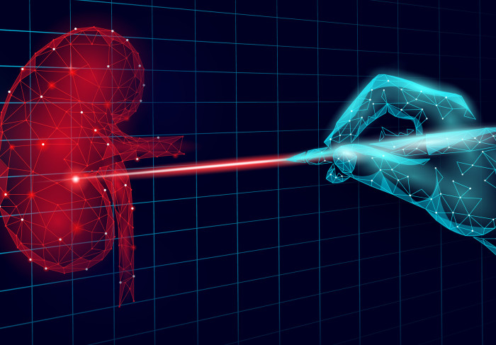3D rendered image of a clinician pointing a laser at a kidney