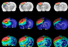 Precise mapping shows how brain injuries inflict long-term damage